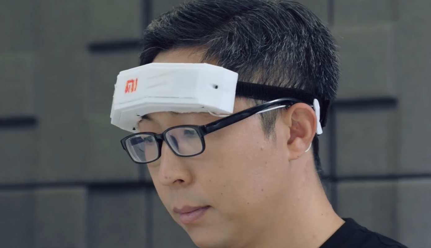 Xiaomi Podtverzhdaet Status Novatora Anonsom Migu Headband I Drugie Novosti 1